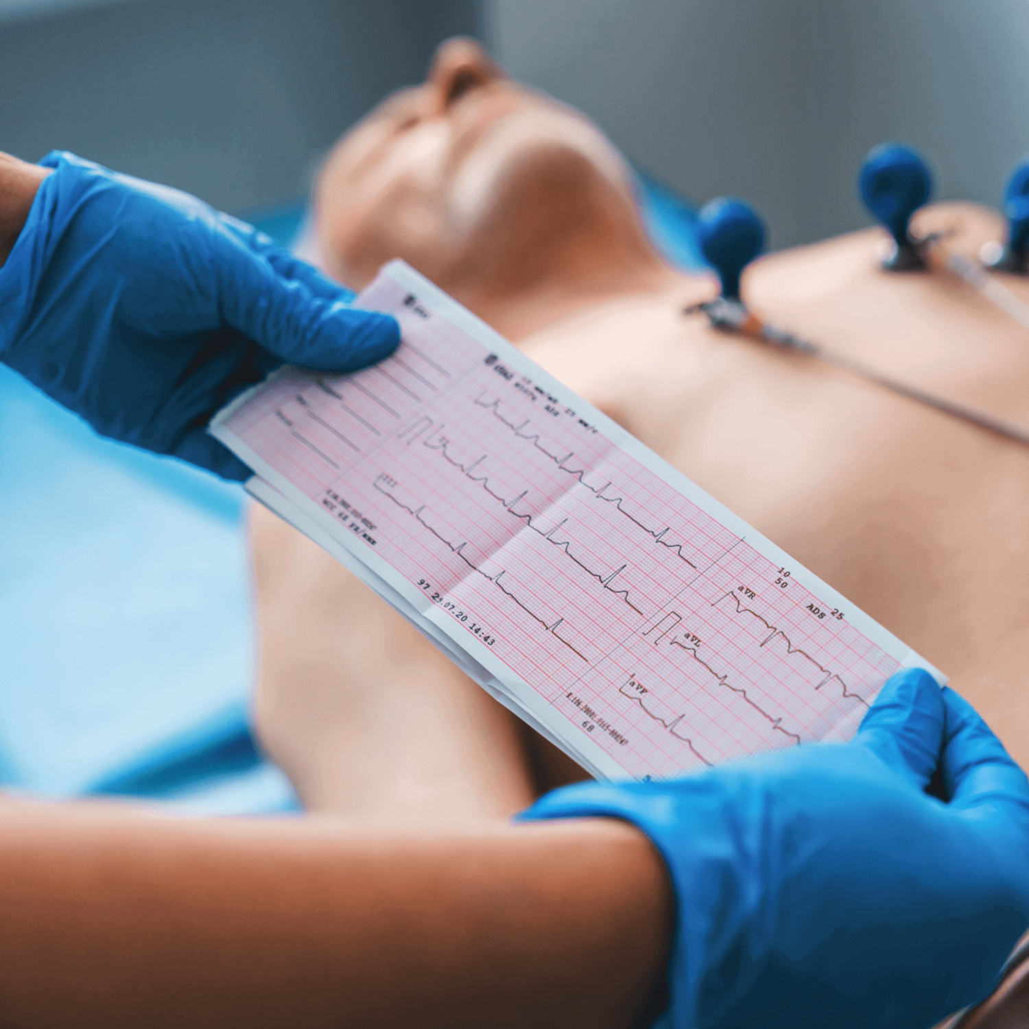 Electrocardiography (ECG)